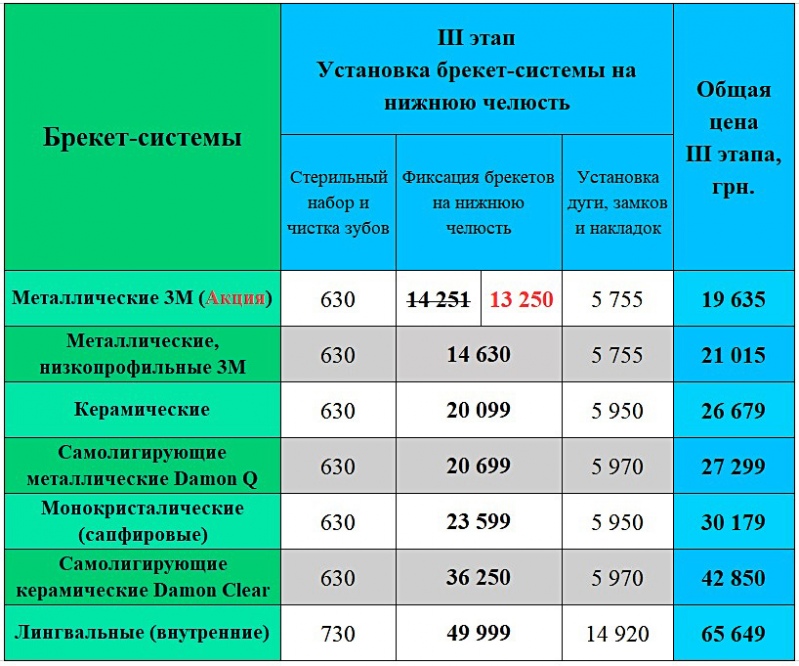 Установка брекет-системы цена Киев ЛюмиДент
